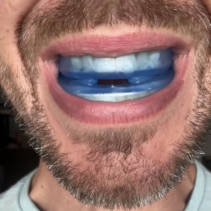 Zquiet Benevita- The Quiet Anti-Snoring Mouthpiece Universal Size